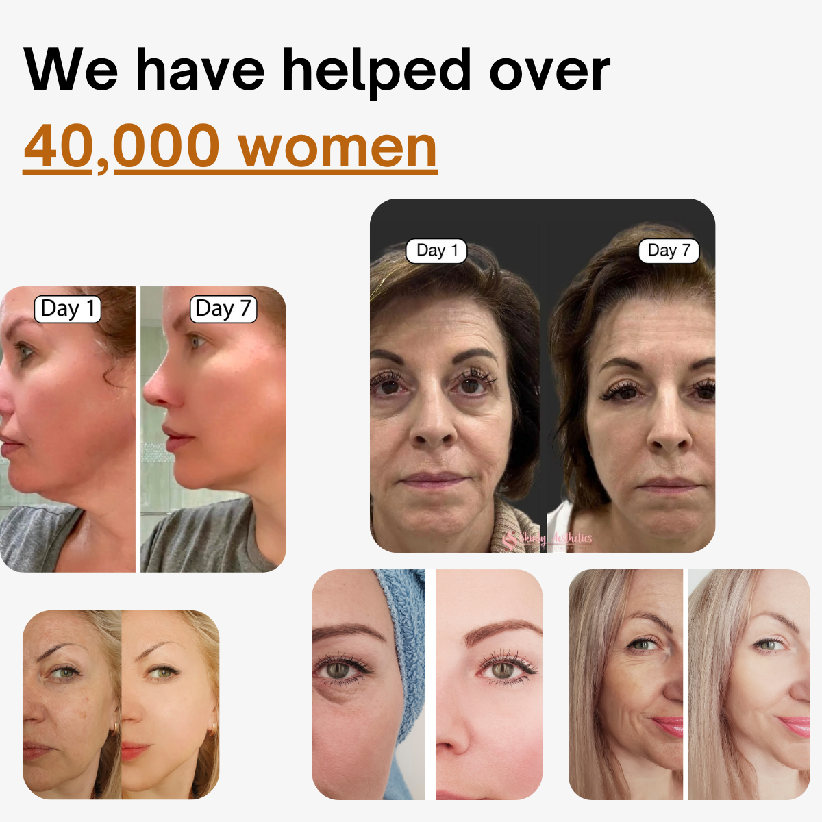 ODALIT™ Lymphatic Face Brush — Instantly Reduce Puffiness & Sculpt Your Jawline