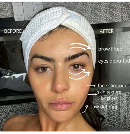 ODALIT™ Lymphatic Face Brush — Instantly Reduce Puffiness & Sculpt Your Jawline