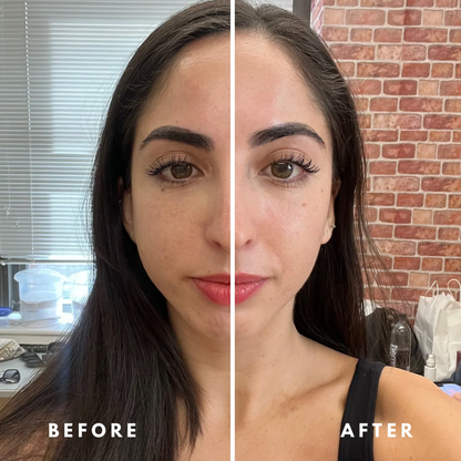 ODALIT™ Lymphatic Face Brush — Instantly Reduce Puffiness & Sculpt Your Jawline